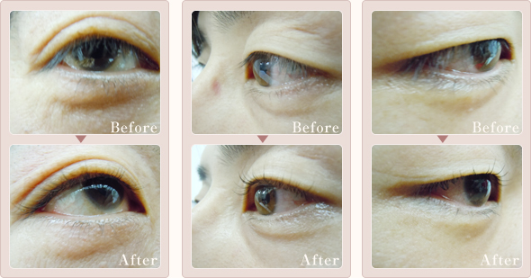 �j���̂��q�l�J�[��